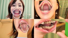 Iroha - Watching Inside mouth of Japanese attractive mature lady - wmv 1080p