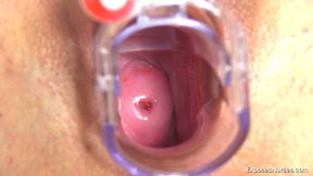 Toys and medical tools inside a wide-open brunette hole