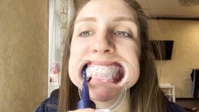 Unusual teeth cleaning